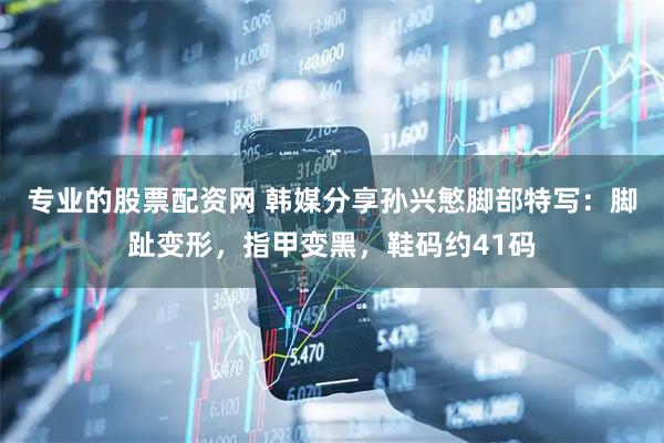 专业的股票配资网 韩媒分享孙兴慜脚部特写：脚趾变形，指甲变黑，鞋码约41码